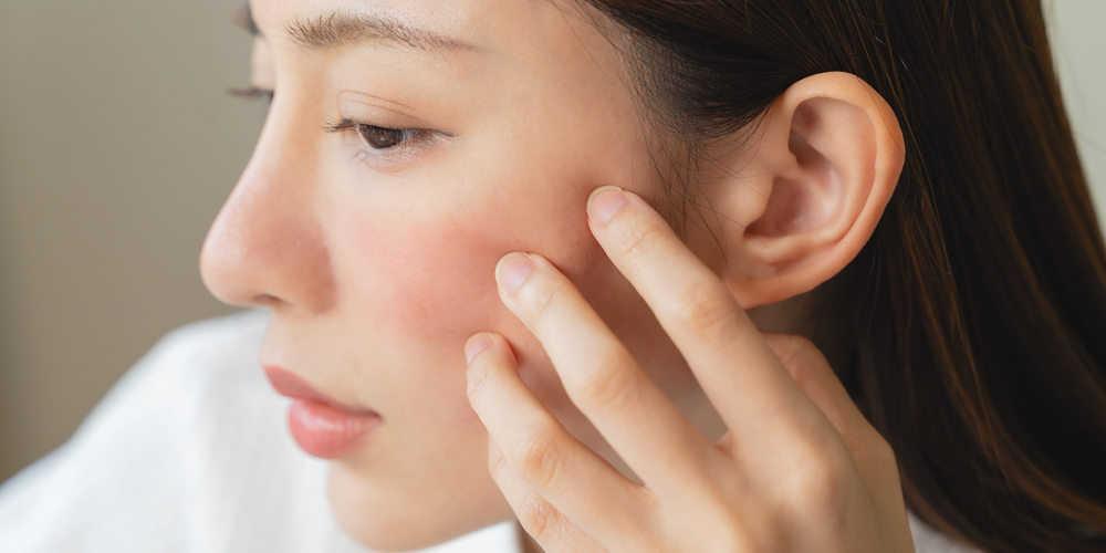 Quiz: Do I have sensitive skin?