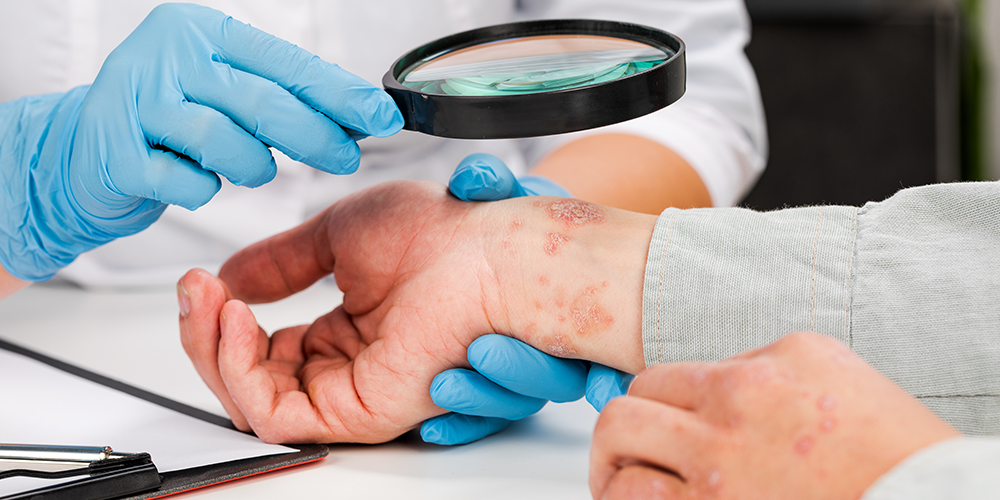 Fact or Fiction: How much do you really know about eczema?
