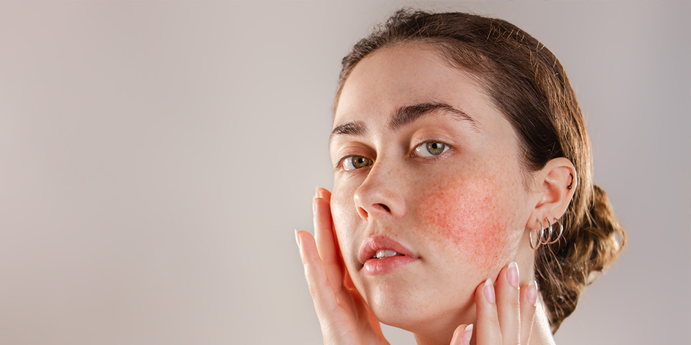 10 questions about sensitive skin, answered
