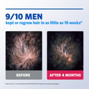 Regaine Hair Loss Foam Treatment For Men 1 Month Supply 60g thumbnail 7