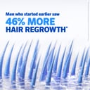 Regaine Hair Loss Foam Treatment For Men 1 Month Supply 60g thumbnail 14