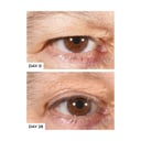 freezeframe Non Surgical Eyelid Lift 15ml thumbnail 2