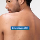 Mixa Niacinamide 250ml thumbnail 5