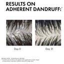 Dercos Anti-Dandruff Dandruff Shampoo Dry Hair 200ml thumbnail 5