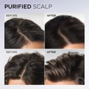 L'Oreal Paris Hyaluron Pure Scalp Serum 102ml thumbnail 7