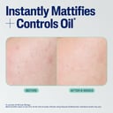 Cetaphil Mattifying Blemish Moisturiser 100ml thumbnail 10