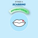 Virasolve Cold Sore Cream 5g thumbnail 8