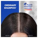 Head & Shoulders Advanced Itch Care Shampoo 300ml thumbnail 7