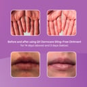 Ego QV Dermcare Sting-Free Ointment 200g thumbnail 3