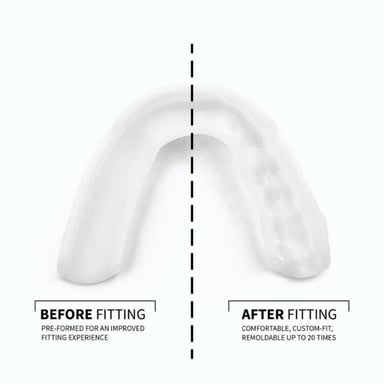 Sova 3D Night Teeth Grinding Guard 1 unit