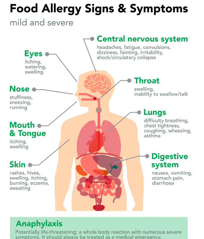 Areas of body being affected by Food Allergy