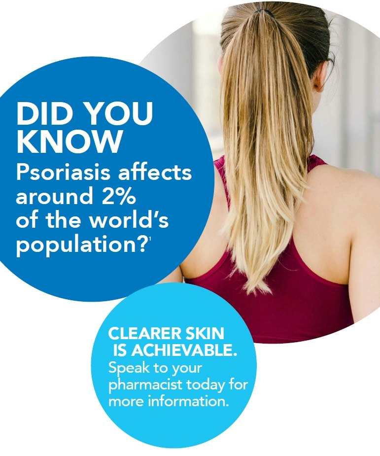 Psoriasis affects 2% of world's population