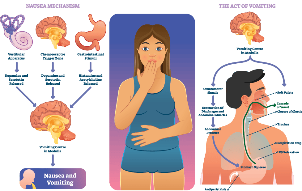 what happens when we vomit?