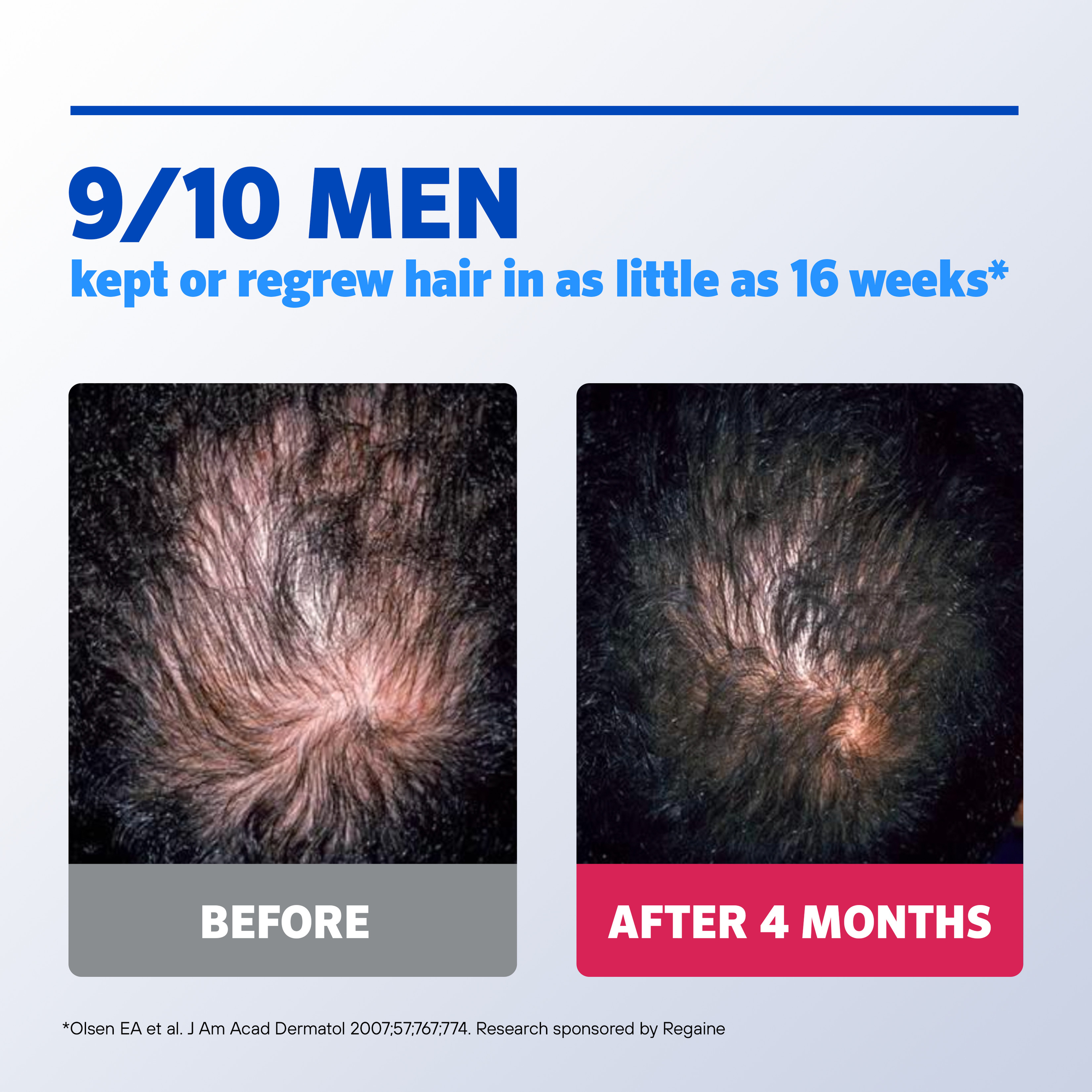 Regaine Hair Loss Foam Treatment For Men 1 Month Supply 60g - Image 6