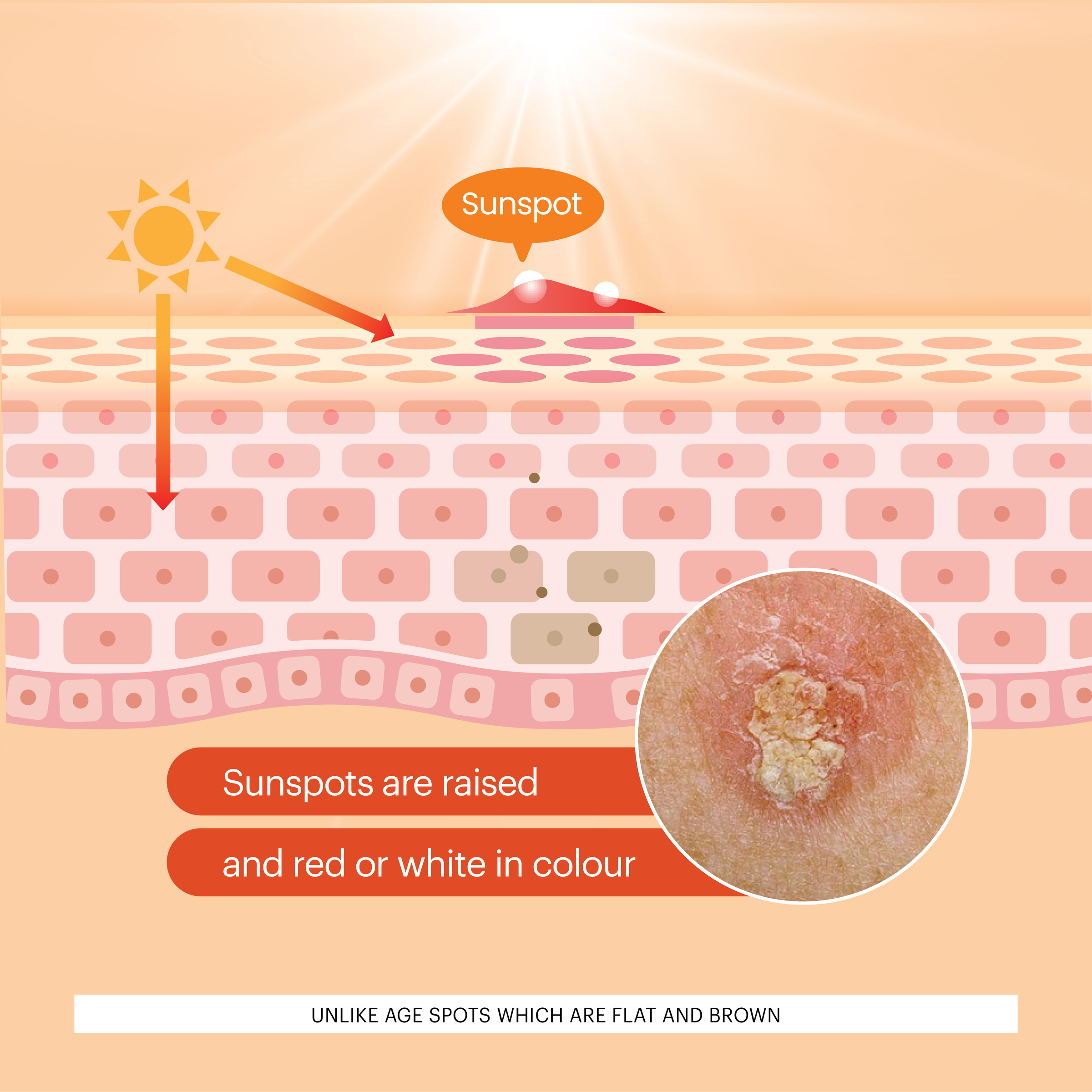 John Plunkett's Sunspot Cream 100g - Image 11