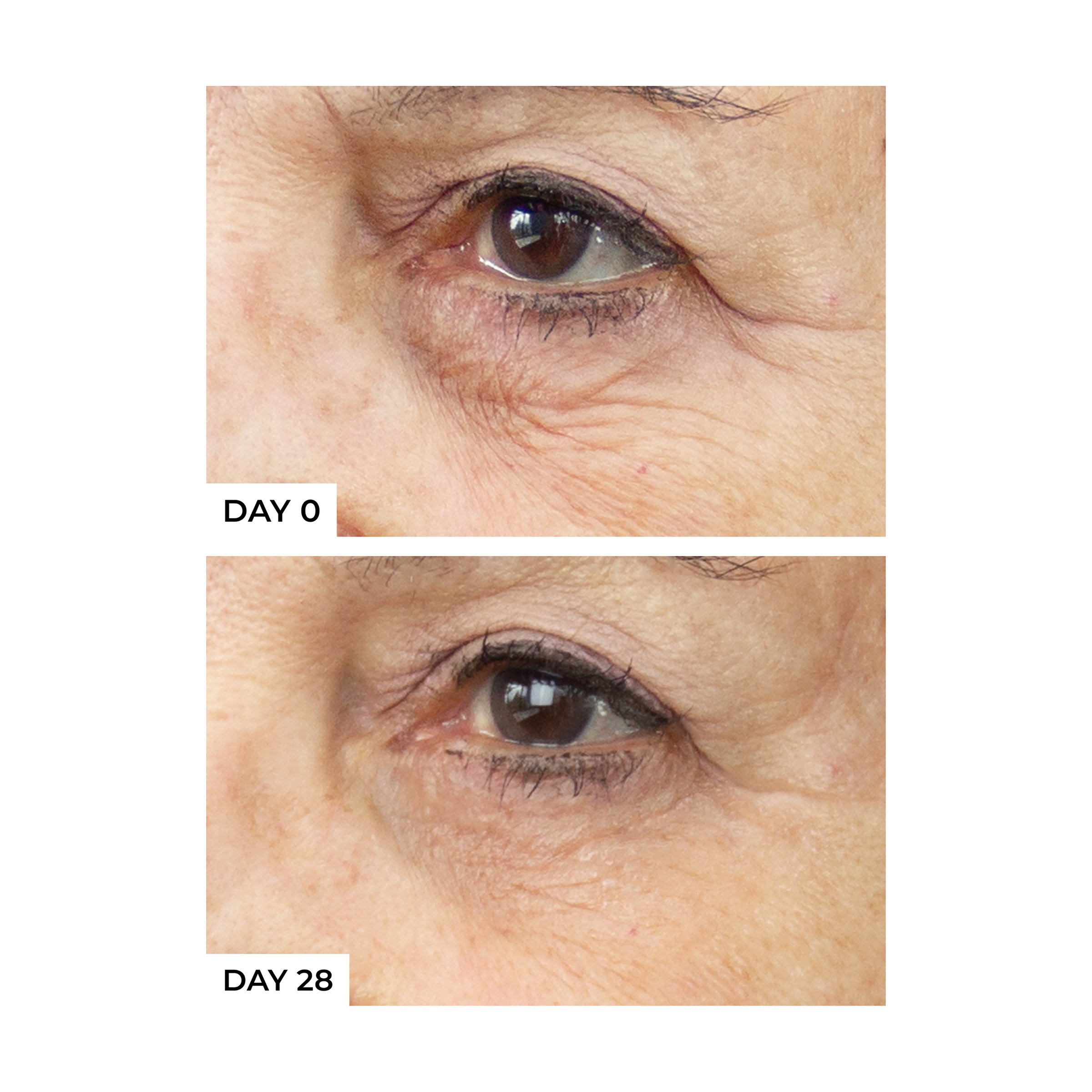 freezeframe Revitaleyes 15ml - Image 2