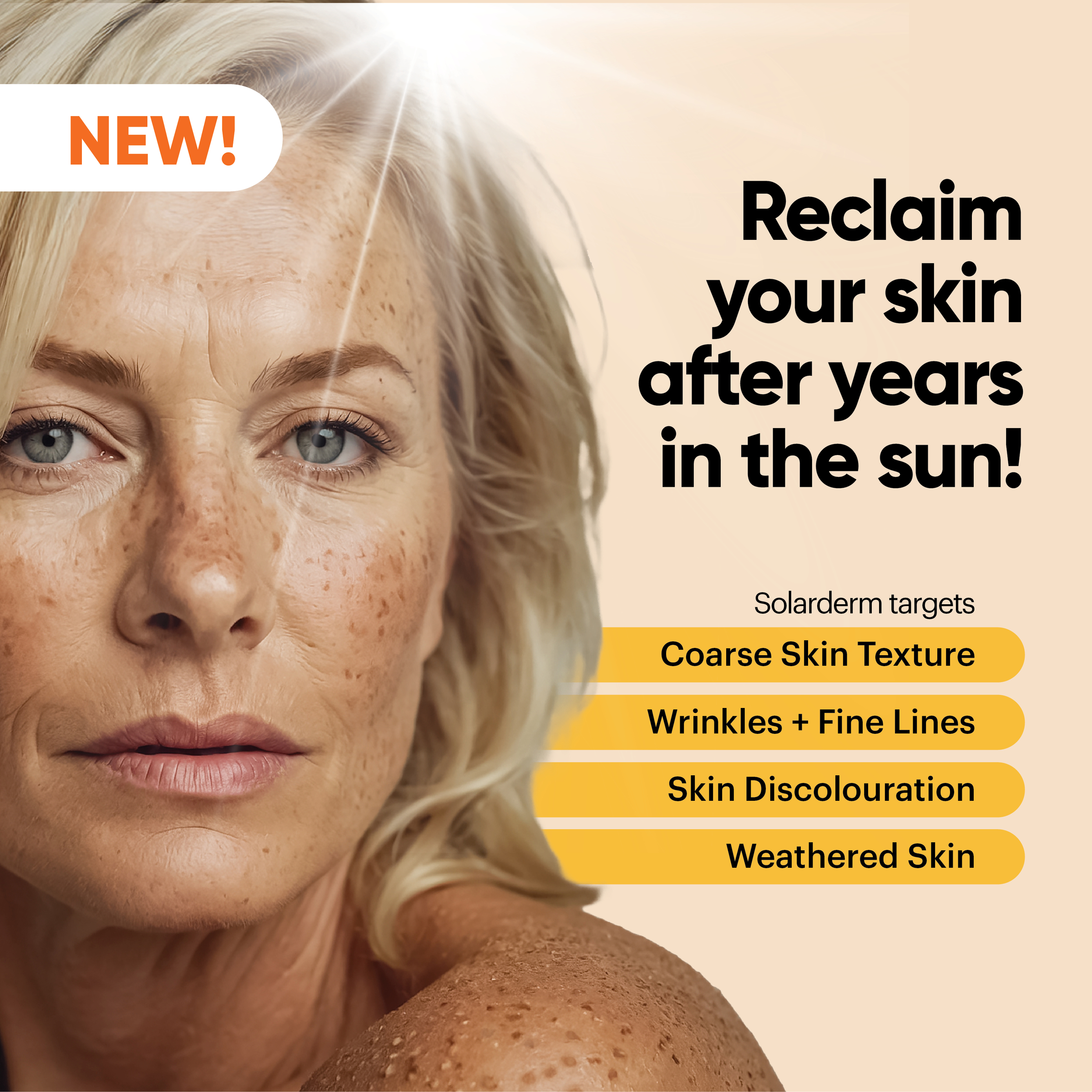 John Plunkett's Solarderm Face & Body Recovery Cream 85ml - Image 8