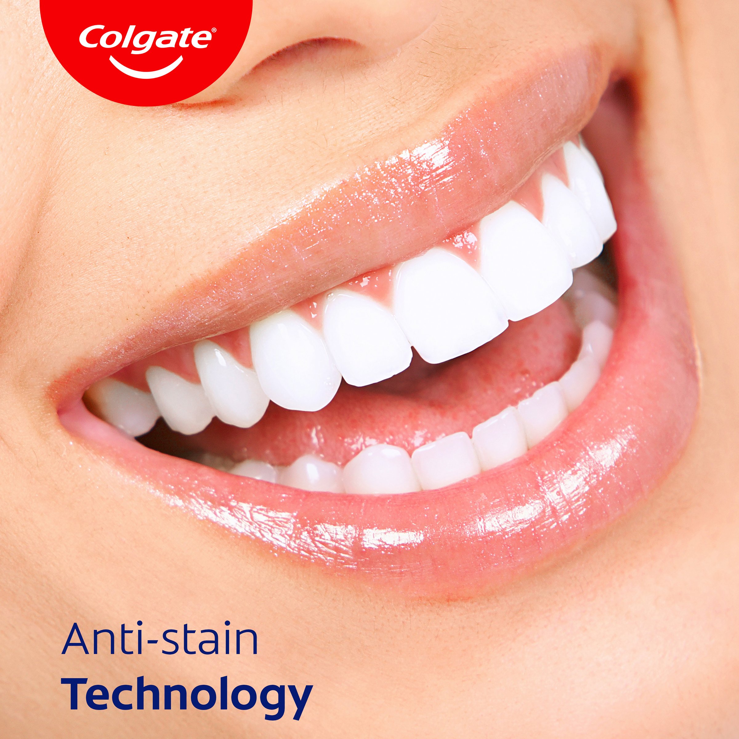 Colgate Savacol Low Stain 300ml - Image 6