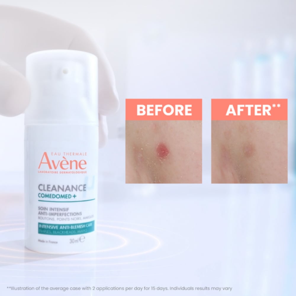 Avene Cleanance Comedomed+ Intensive Anti-Blemish Care 30ml - Image 3