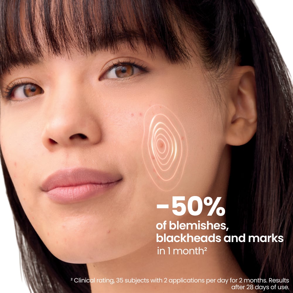 Avene Cleanance Comedomed+ Intensive Anti-Blemish Care 30ml - Image 10
