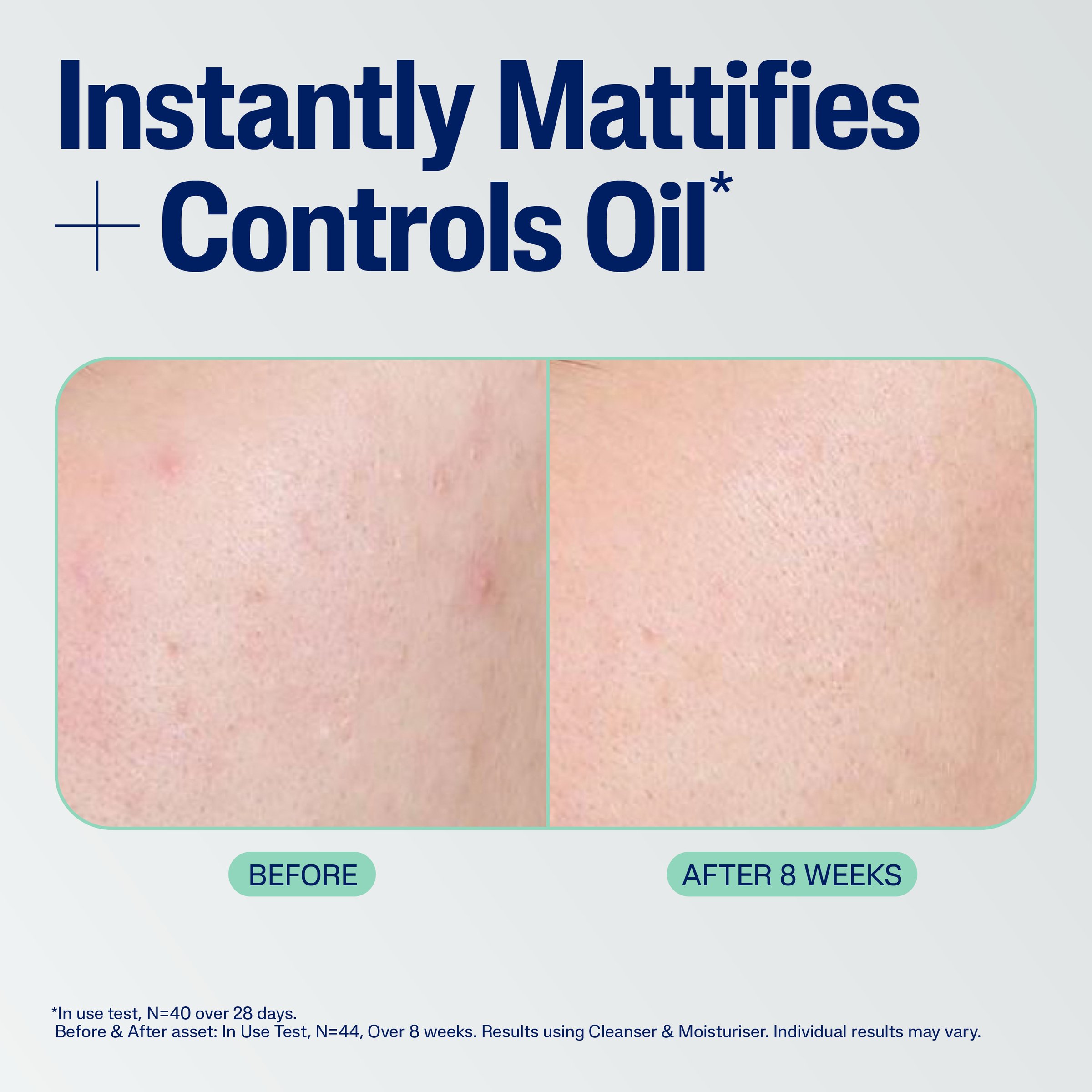 Cetaphil Mattifying Blemish Moisturiser 100ml - Image 10
