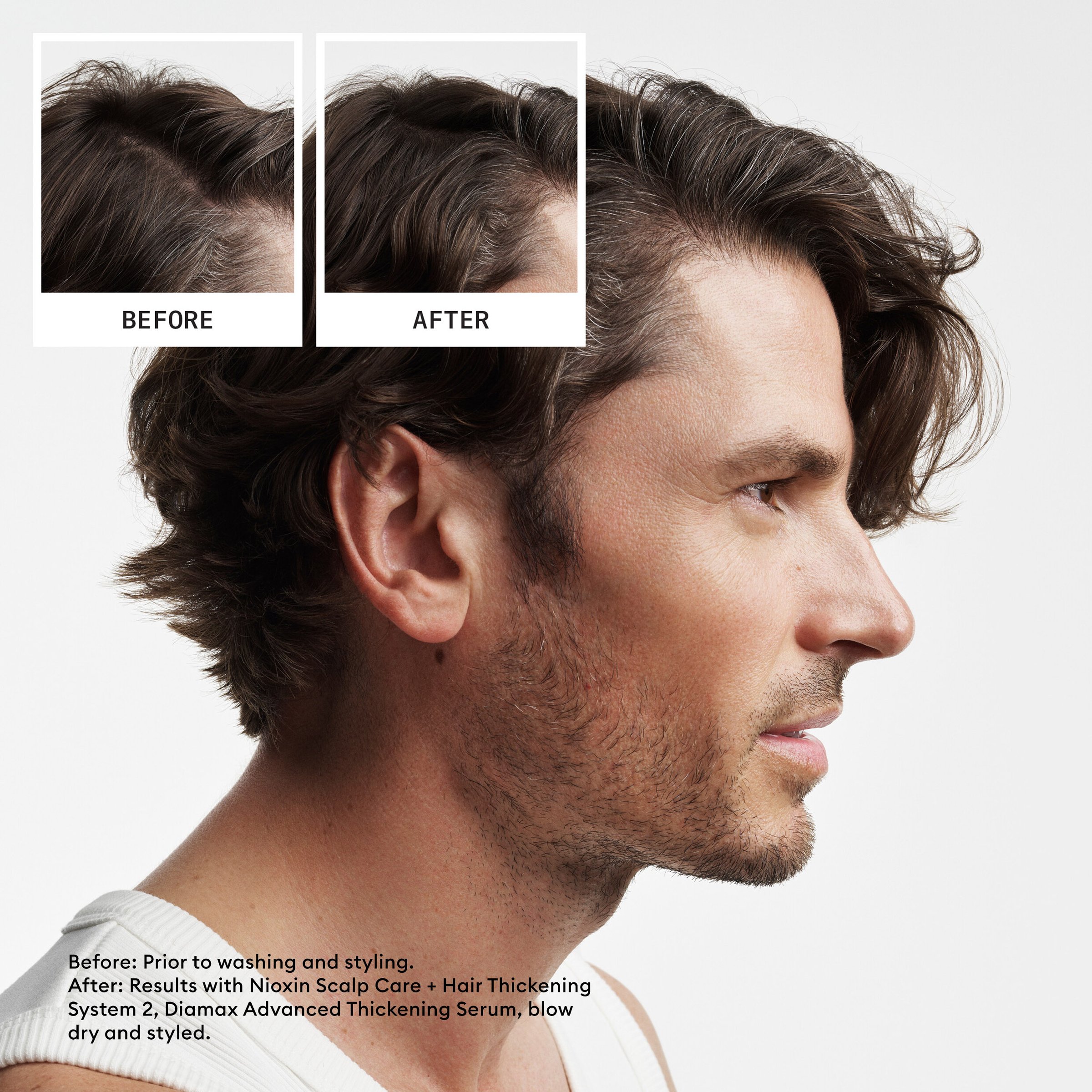 Nioxin Scalp + Hair Thickening System 2 Trial Kit 1 pack - Image 2