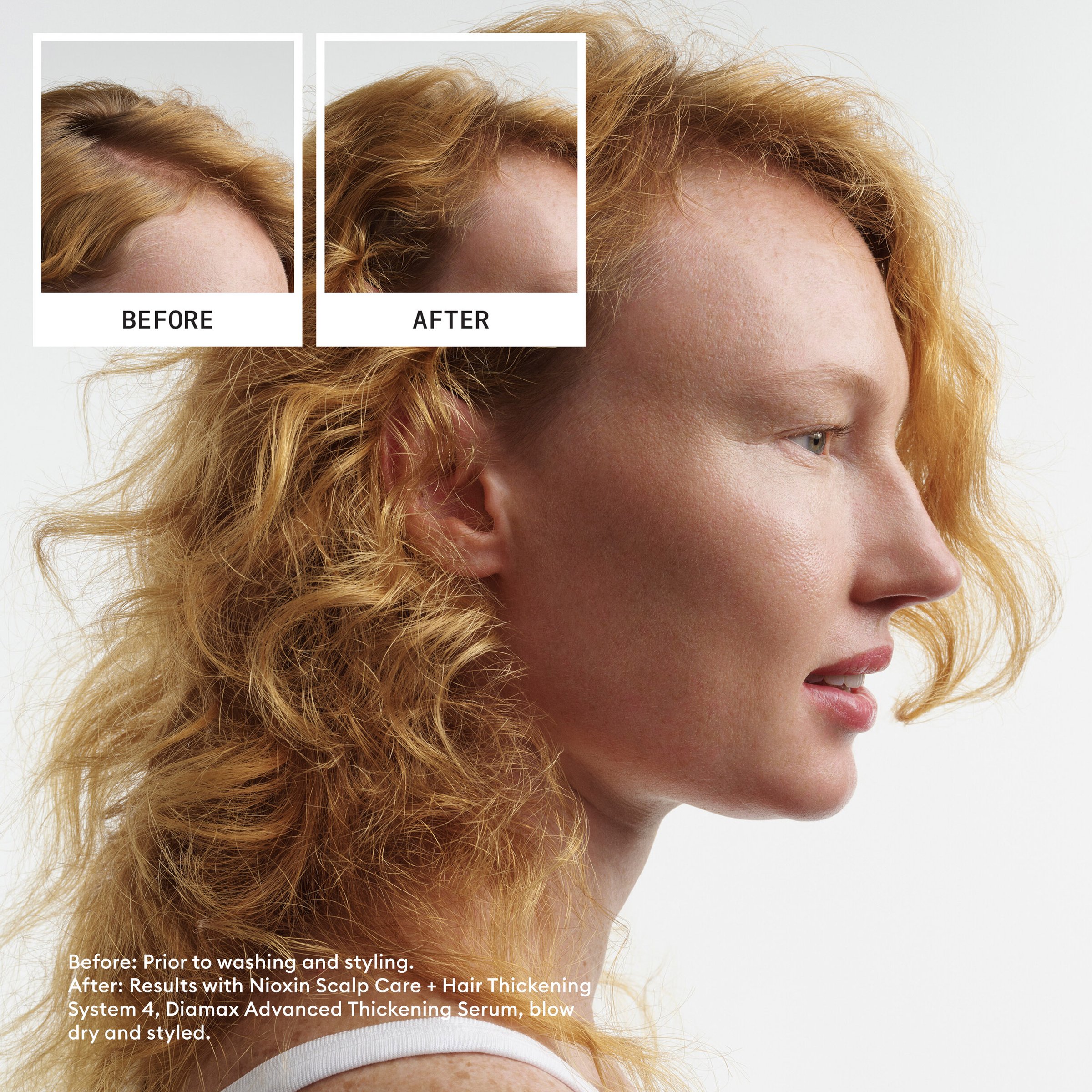 Nioxin Scalp + Hair Thickening System 4 Trial Kit 1 pack - Image 2