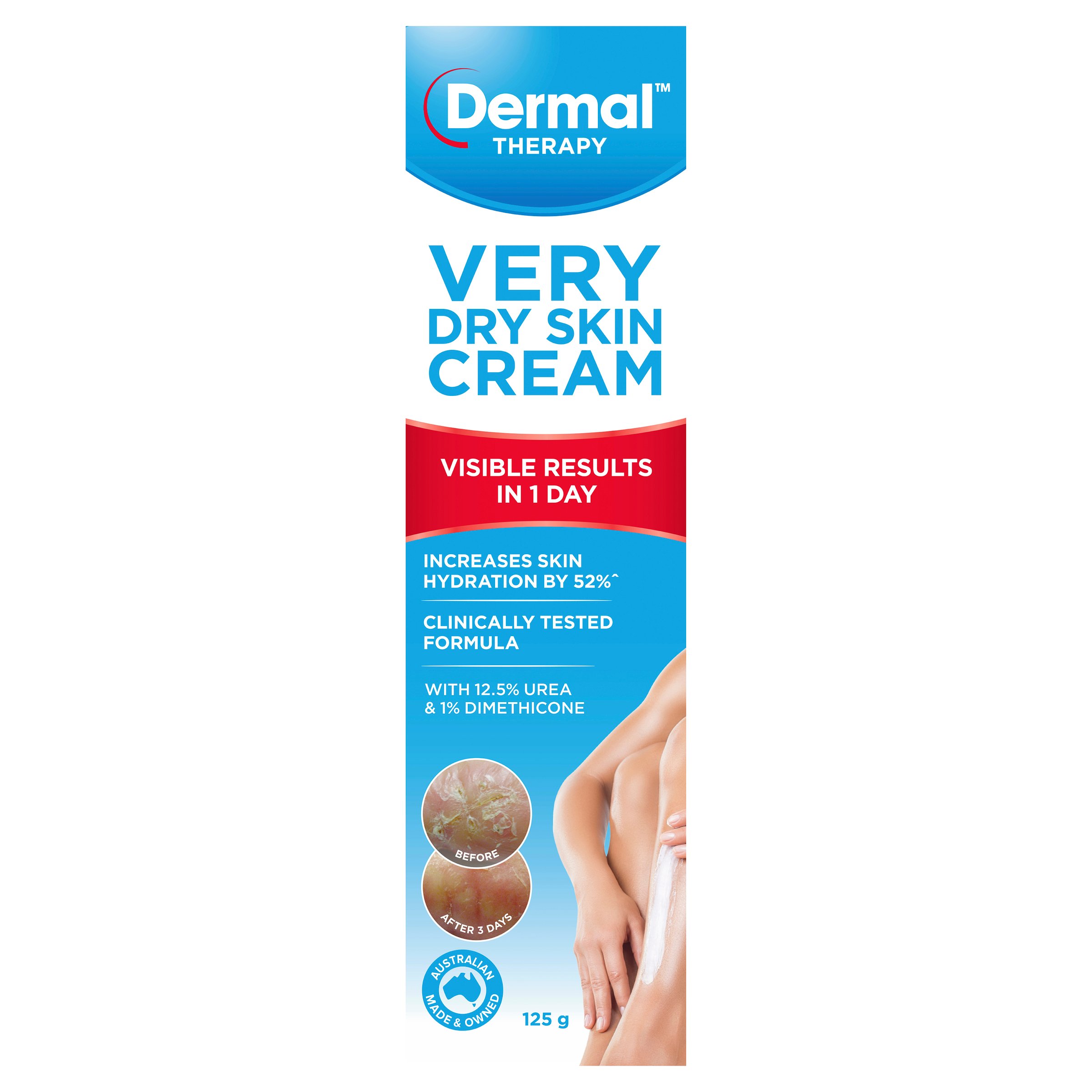 Dermal Therapy Very Dry Skin Cream 125g - Image 5