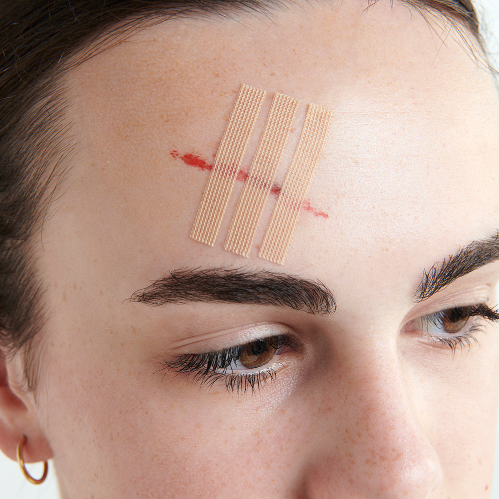 Leukostrip Wound Closure Strips 6.4mm X 76mm - 3 pack - Image 3