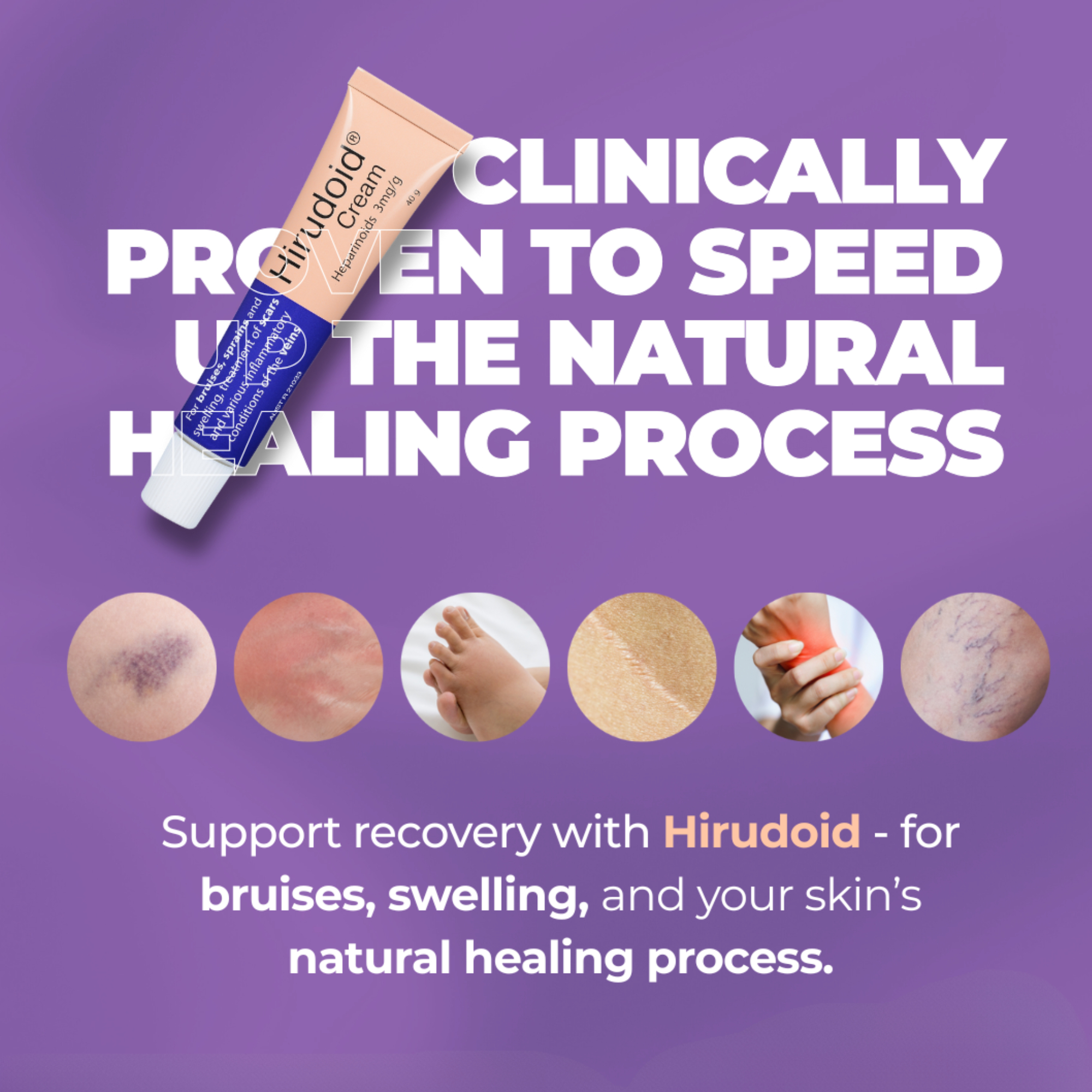 Hirudoid Cream 20g - Image 5