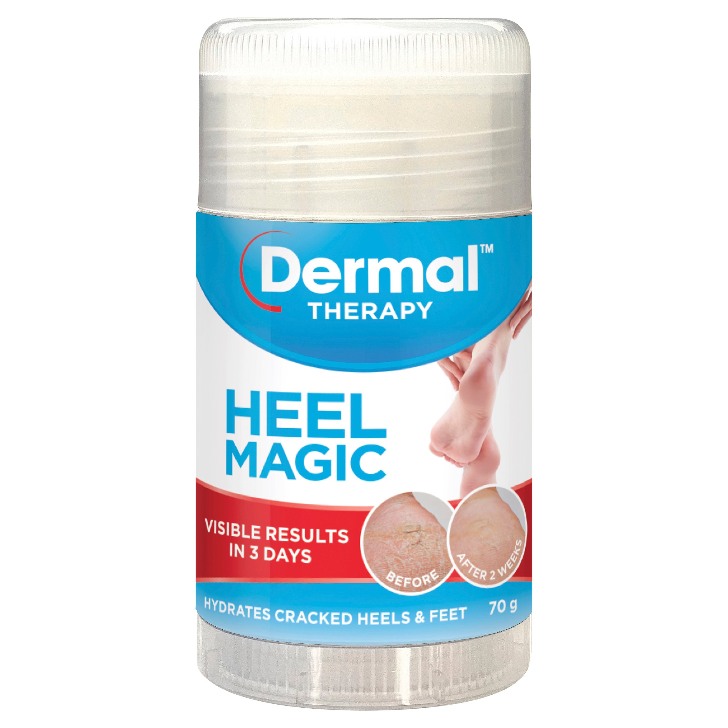 Dermal Therapy Heel Magic 70g - Image 1