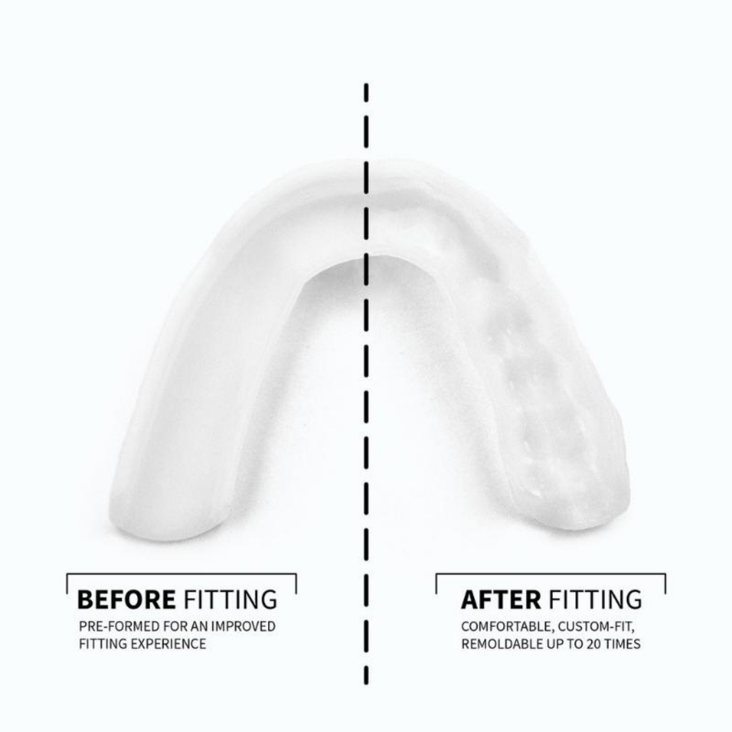 Sova 3D Night Teeth Grinding Guard 1 unit - Image 1